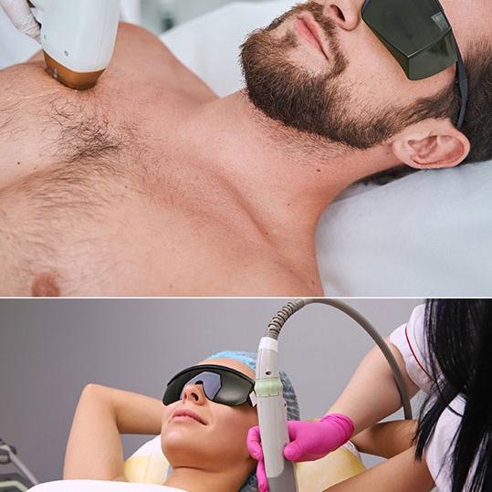 6 Laser Hair Removal Small Areas