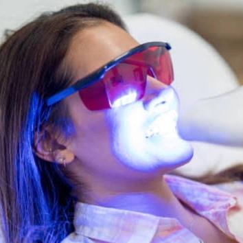 3 sessions of Teeth Whitening