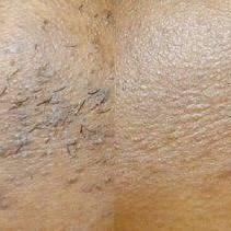 Radiant Chin Renewal